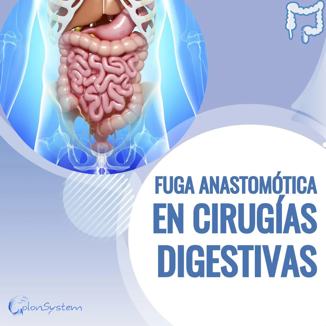 Fuga anastomosis en cirugías digestiva