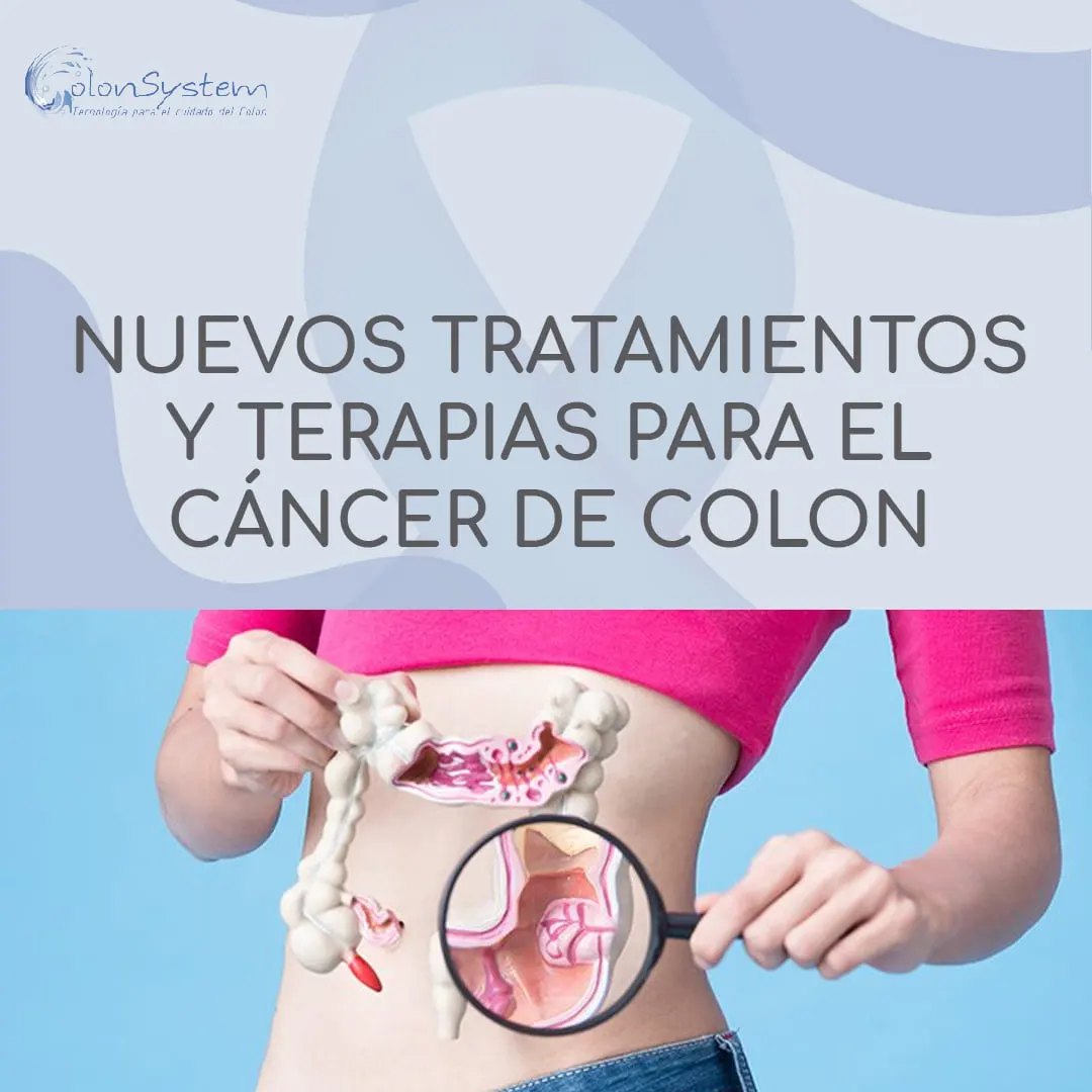 Nuevos tratamientos y terapias para el cáncer de colon